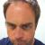 texburgher
